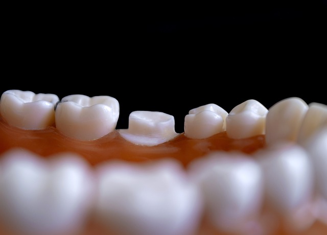 Kodėl verta rinktis natūraliai atrodančias dantų laminates? Odontologo požiūris
